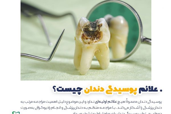 علائم پوسیدگی دندان چیست⁉️