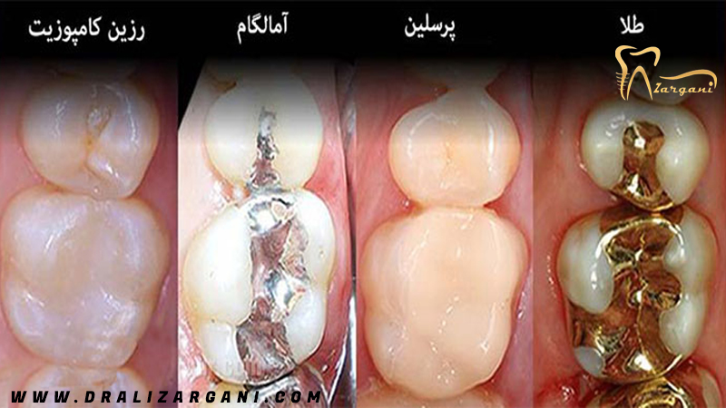  دکتر علی زرگانی | بهترین دندانپزشک ترمیمی و زیبایی در تهران