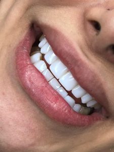 دندانپزشک زیبایی فرمانیه | دکتر علی زرگانی |