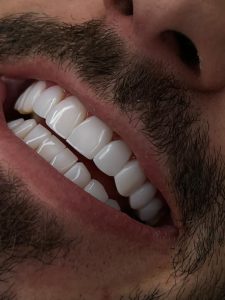دندانپزشک زیبایی فرمانیه | دکتر علی زرگانی |